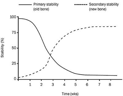 Bone and Cartilage Interfaces With Orthopedic Implants: A Literature Review